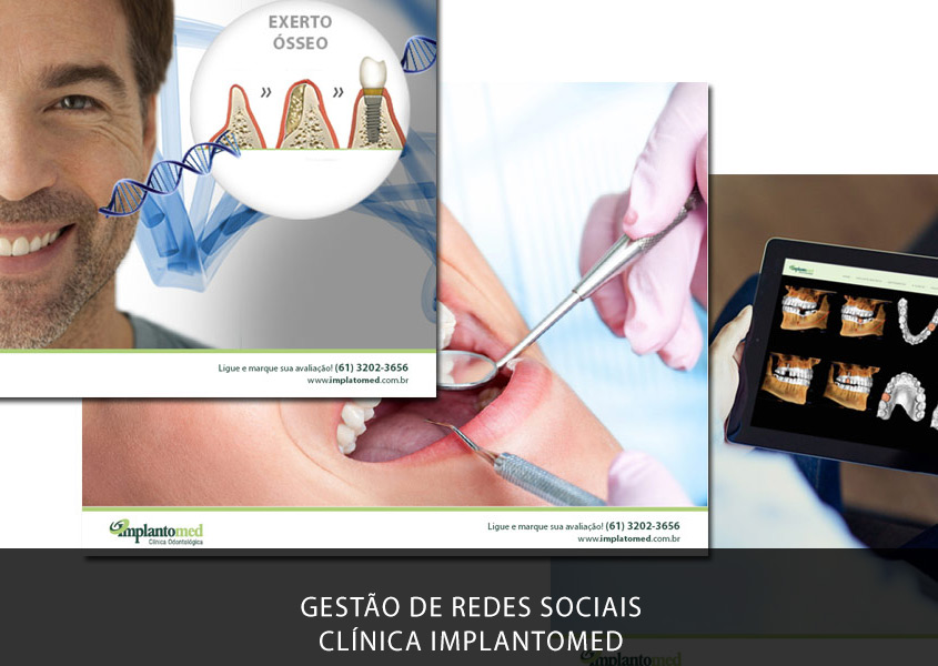 Gestão de Redes Sociais (Social Mídia) e Marketing Odontológico da clínica odontológica Implantomed.